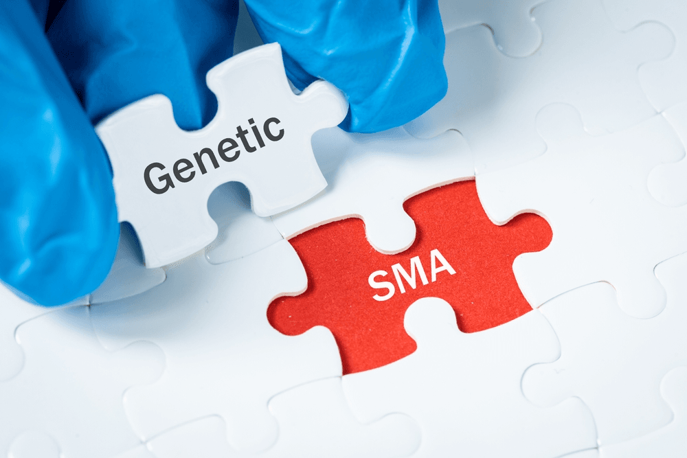 Enhancing Life with SMA Through Strategic Management