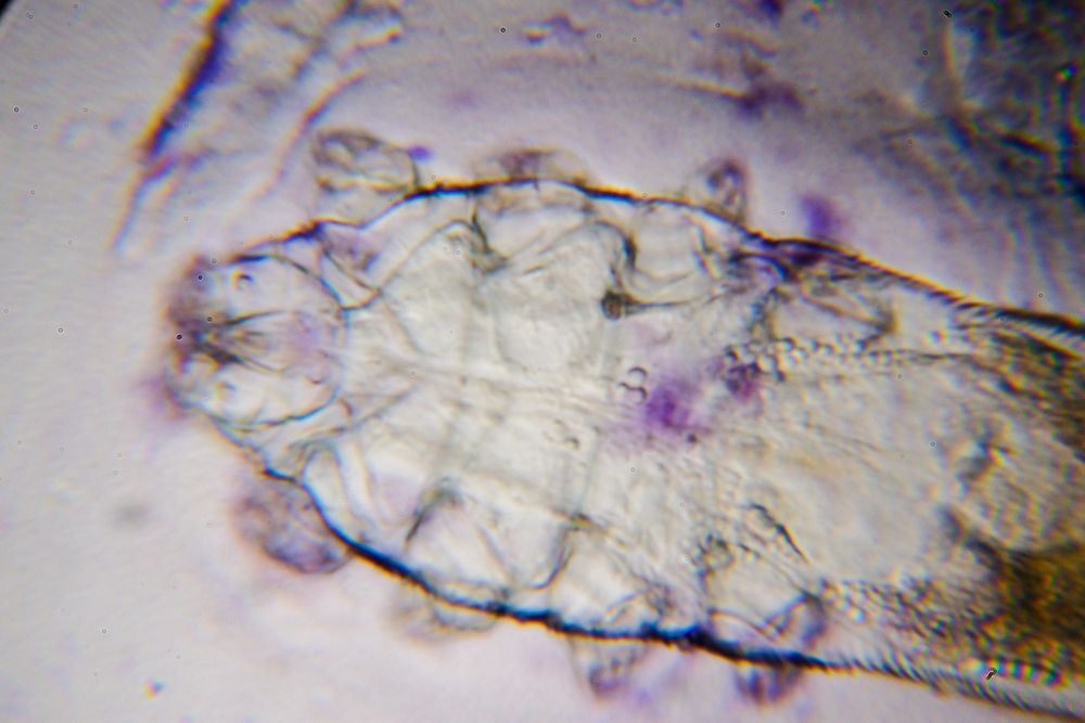 Face Mites: Causes and Solutions